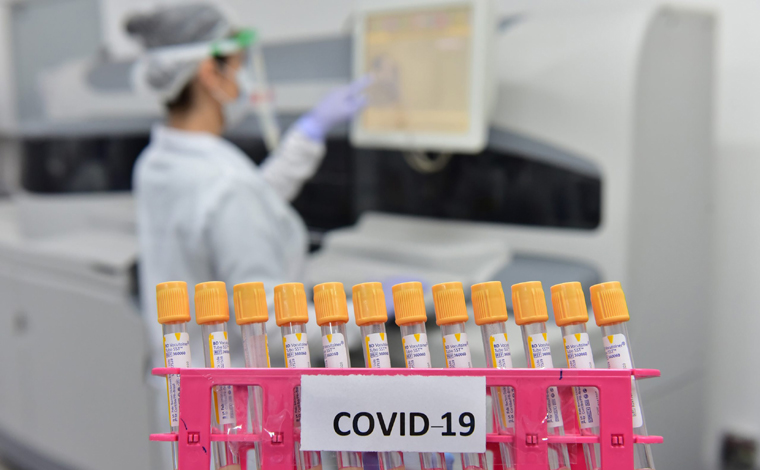 Boletim Epidemiológica: Sete Lagoas confirma mais oito casos de Covid-19 nas últimas 24h