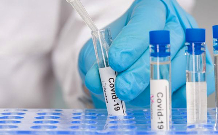 Boletim Epidemiológica: Sete Lagoas confirma mais seis casos de Covid-19 nas últimas 24h