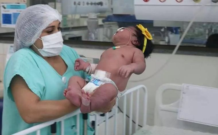 ‘Suberbebê’: criança nasce com mais de 7 kg e 61 cm no Pará e surpreende pais e equipe médica