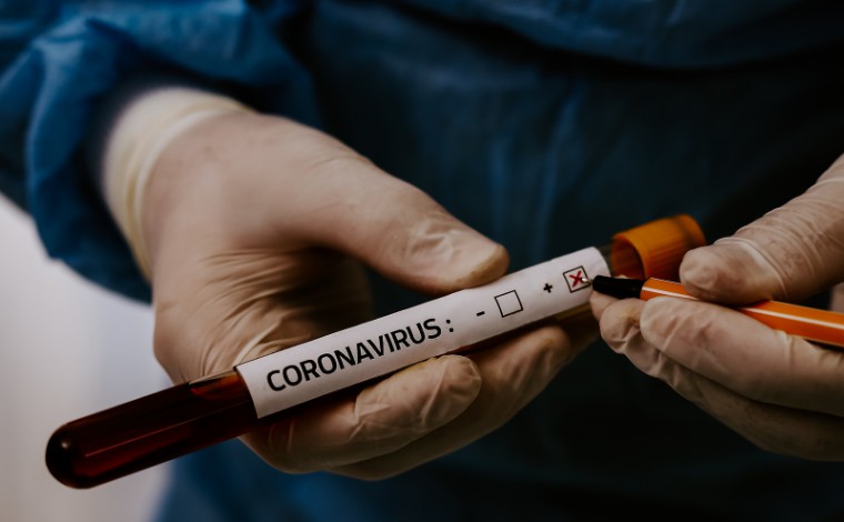 Boletim Epidemiológico: Sete Lagoas confirma mais três casos de Covid-19 nas últimas 24h
