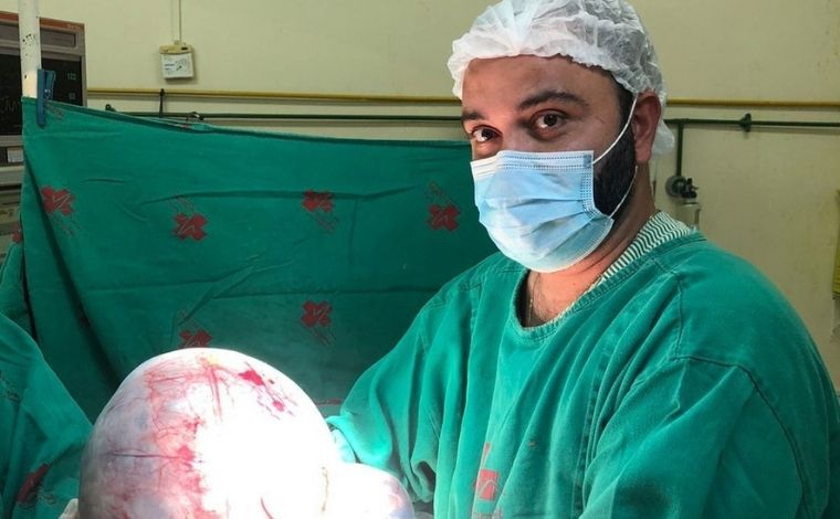 Médico retira cisto com cerca de 10kg de ovário de idosa; imagens impressionam 