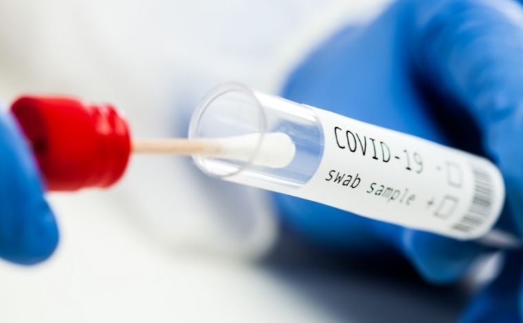 Covid-19: Sete Lagoas confirma mais 121 casos da doença nesta quarta-feira (22)