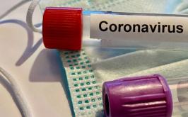Boletim Epidemiológico: Sete Lagoas confirma mais 153 casos Covid nesta sexta-feira (1◦)