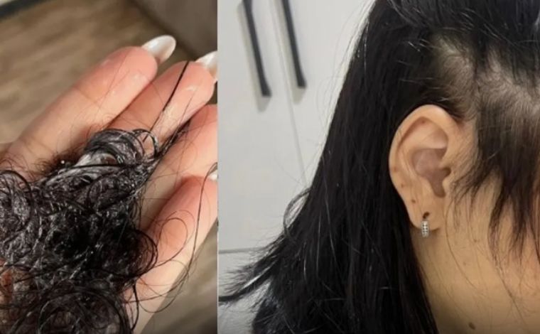 Mulheres denunciam queda de cabelo após tratamento de beleza em salão de Santa Luzia  