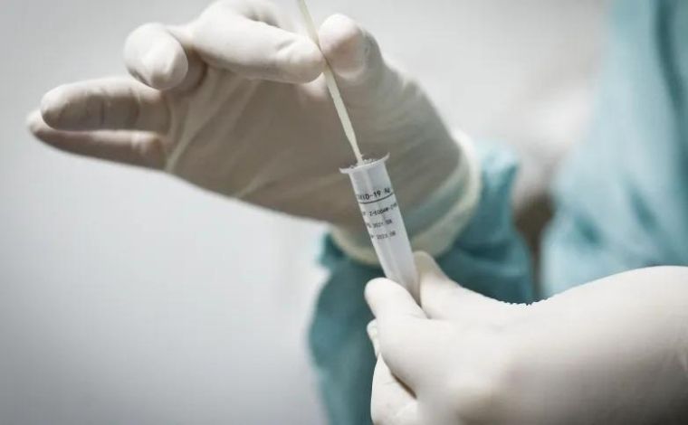 Boletim Epidemiológico: Sete Lagoas confirma mais 61 casos da Covid-19