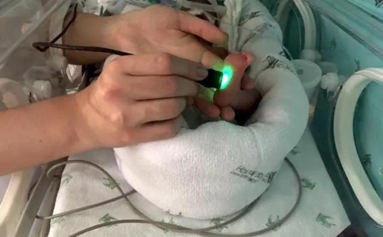 Pesquisadores da UFMG criam aparelho com luz de LED para ajudar prematuros