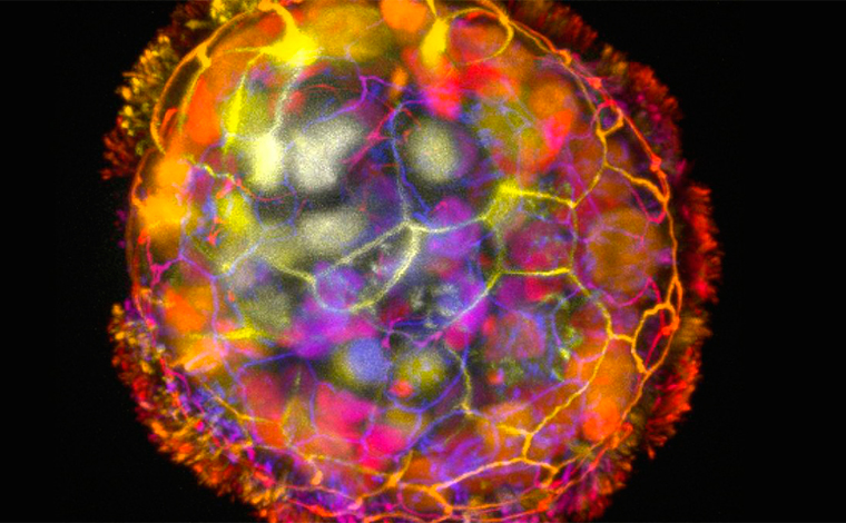 Cientistas constroem robôs com função curativa usando células humanas