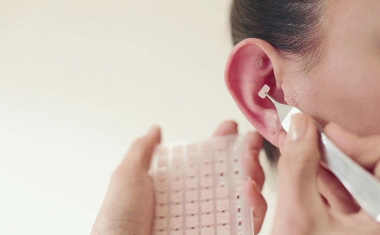 Auriculoterapia: técnica milenar pode tratar e diagnosticar doenças