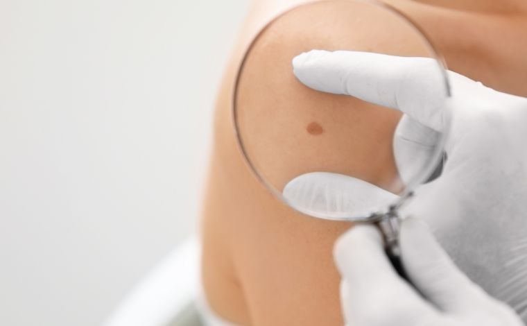 Vacina contra câncer de pele pode estar disponível em 2025, diz CEO da Moderna
