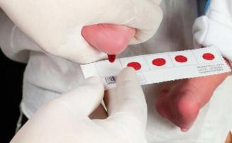 Teste do pezinho em Minas identifica, pela primeira vez, bebê com doença rara