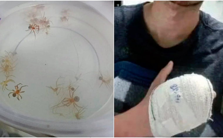 Aranha-marrom: Homem tem dedo amputado após ser picado enquanto dormia; saiba como identificá-la