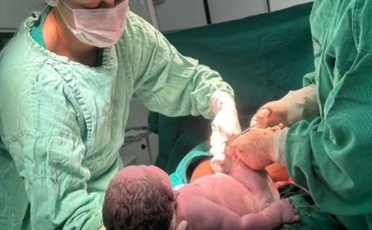 Bebê nasce com mais de 6kg e bate recorde em hospital de Minas Gerais