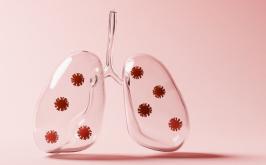 Pneumonia silenciosa: entenda o que é a forma atípica que acende alerta na saúde pública