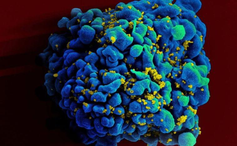 Cientistas desenvolvem nanopartículas de mRNA que podem levar à cura do HIV, diz estudo