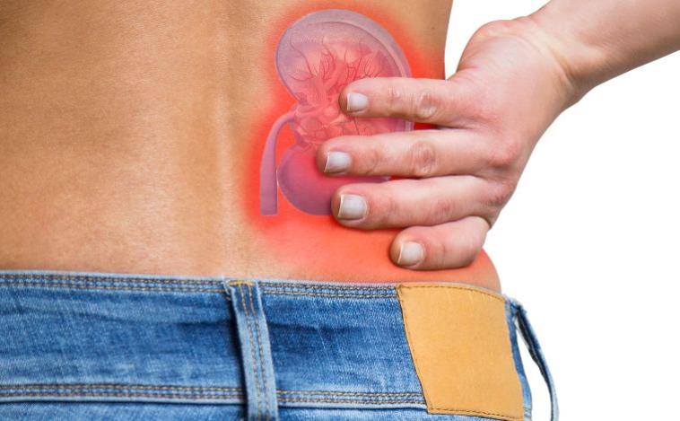 Cinco sinais silenciosos de estresse renal e quais medidas adotar