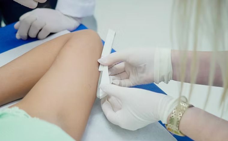 Foto: ReproduÃ§Ã£o - De acordo com o MinistÃ©rio da SaÃºde, a opÃ§Ã£o Ã© considerada vantajosa em relaÃ§Ã£o aos demais contraceptivos em razÃ£o da longa duraÃ§Ã£o (age no organismo por atÃ© trÃªs anos) e eficÃ¡cia alta