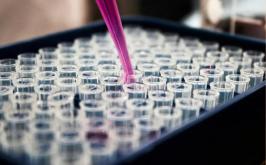 Pesquisas brasileiras avançam no diagnóstico de Alzheimer