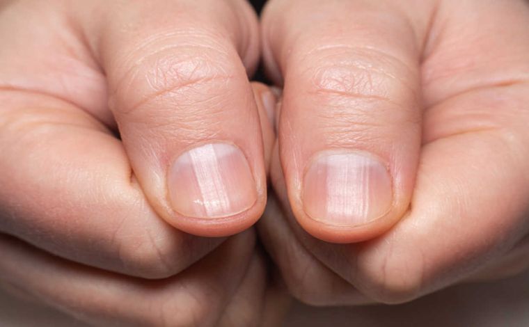 Foto: Shutterstock - O cÃ¢ncer de pulmÃ£o Ã© uma das neoplasias mais letais em todo o mundo. Em mortalidade, Ã© o primeiro entre os homens e o segundo entre as mulheres