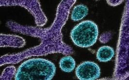 Vírus Nipah: entenda a doença de alta letalidade que causa novo surto na Ásia