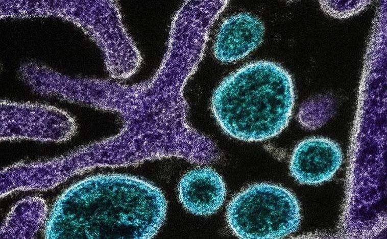 Vírus Nipah: entenda a doença de alta letalidade que causa novo surto na Ásia