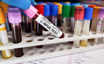 Brasil registra 48 casos de mpox nos primeiros meses de 2026