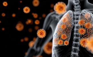 Infecção pulmonar: 10 sintomas que podem indicar doença