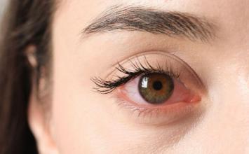 Visão embaçada? Veja como proteger a saúde dos olhos com alimentação