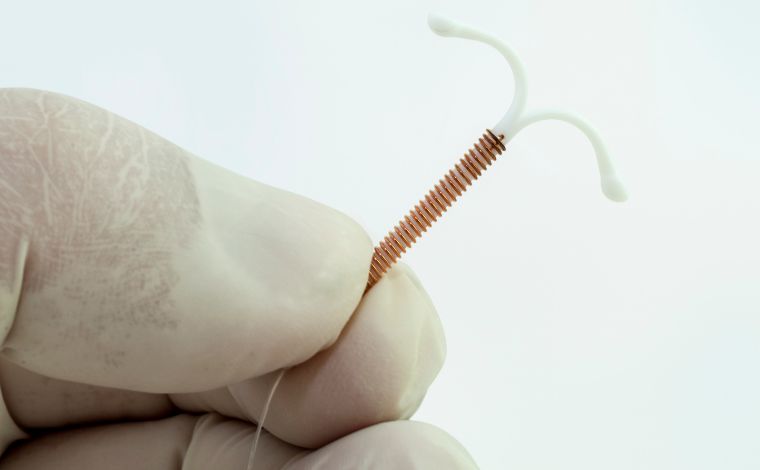 Sete Lagoas amplia acesso ao DIU hormonal para mulheres com endometriose