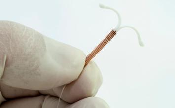 Sete Lagoas amplia acesso ao DIU hormonal para mulheres com endometriose