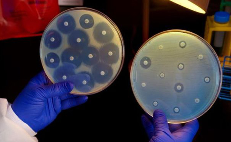 Superbactérias avançam no Brasil e preocupam autoridades de saúde