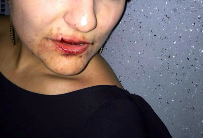 Médica acusa policial de Sete Lagoas de agredi-la com um soco