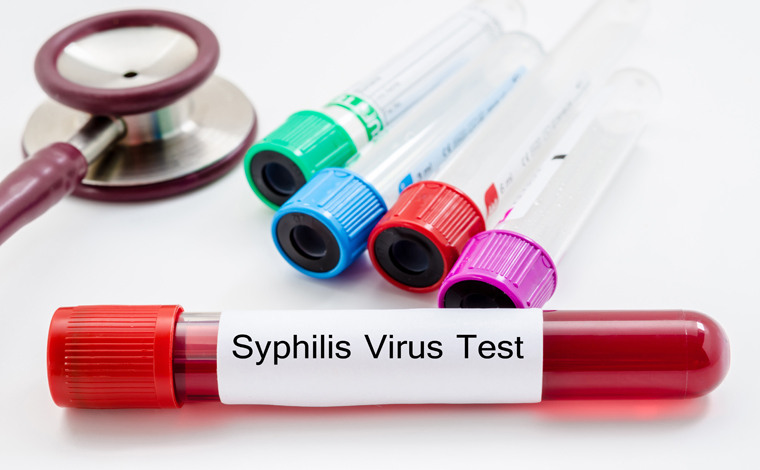 SES-MG alerta para a importância da prevenção e controle da sífilis