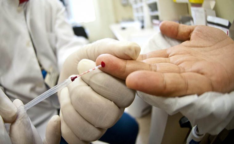 SMS realiza testes rápidos em alusão ao Dia Mundial de Luta Contra a Aids