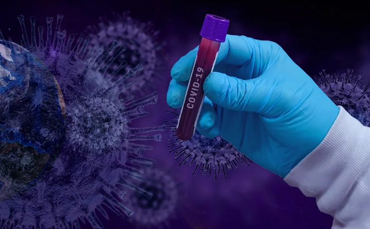 Laboratório montado para exames do novo coronavírus em Sete Lagoas deve iniciar testes nesta semana