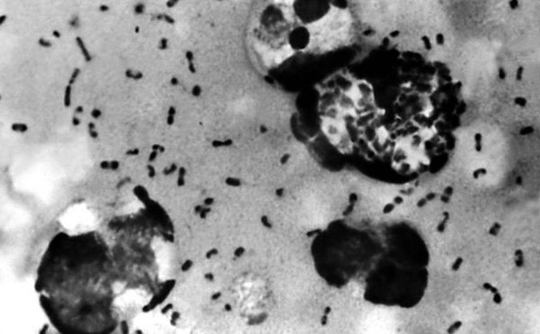 Foto: Getty Imagens - A peste bubÃ´nica, conhecida como 