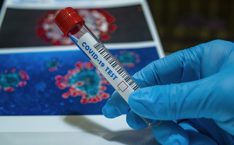 Pacientes na Bélgica e Holanda foram reinfectados pelo novo coronavírus      