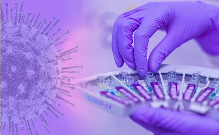 Boletim Epidemiológico: mais um óbito por coronavírus é registrado em Sete Lagoas