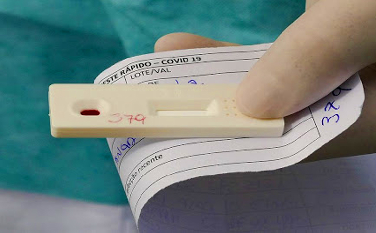 Covid-19: mais dez mil testes rápidos estão disponíveis nas unidades de saúde de Sete Lagoas 