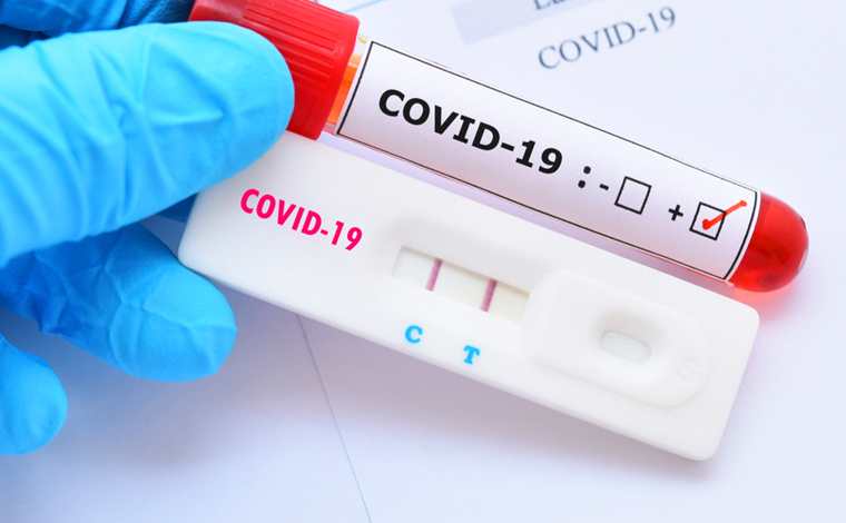 Boletim Epidemiológico: mais três óbitos e 78 casos de Covid-19 são registrados em Sete Lagoas