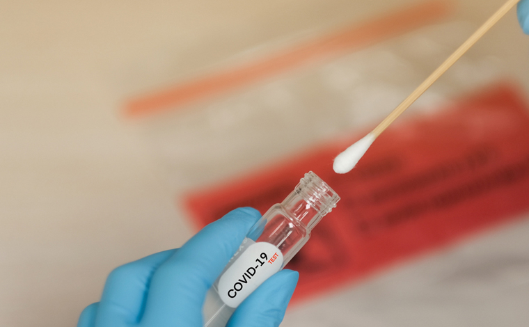 China acredita em teste anal para detecção do novo coronavírus